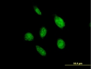 H00058495-B02 - OVOL2 / ZNF339