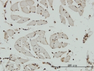 H00064151-M01 - NCAPG