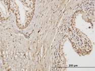 H00064284-M01 - RAB17