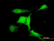 H00064326-M01 - RFWD2 / RNF200