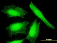 H00064359-B01P - Nucleoredoxin