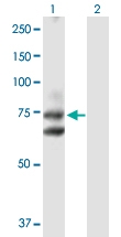 H00064399-D01P - Hedgehog-interacting protein / HHIP