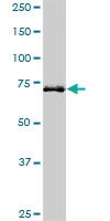 H00064399-M01 - Hedgehog-interacting protein / HHIP