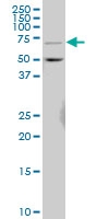 H00064781-A01 - Ceramide Kinase