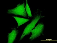 H00064837-B01P - KLC2
