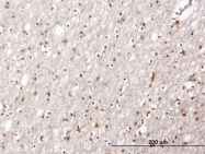 H00064838-B01 - FNDC4