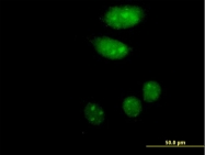 H00064843-B01P - Islet-2 / ISL2