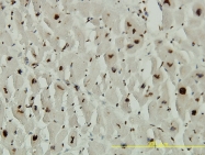 H00065057-M02 - ACD