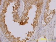 H00065108-M02 - MARCKS-like 1