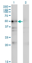 H00065220-M01 - NAD kinase