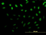 H00065243-B01 - ZNF643