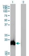 H00079026-M01 - AHNAK / PM227