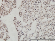 H00079039-M01 - DDX54