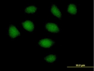 H00079048-B01 - SECISBP2