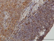 H00079084-M01 - WDR77 / MEP-50