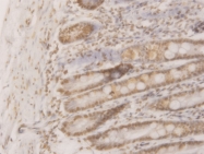 H00079228-M01 - WDR58 / THOC6