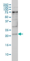 H00079706-M05 - PRKRIP1