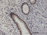 H00079706-M08 - PRKRIP1