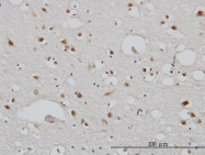 H00079718-M01 - TBL1XR1