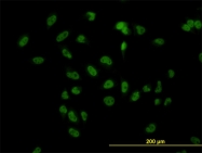 H00079718-M01 - TBL1XR1