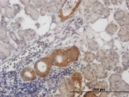 H00079800-M01 - ALS2CR8 / CARF