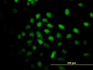 H00079800-M01 - ALS2CR8 / CARF