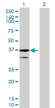 H00079814-B01P - Agmatinase