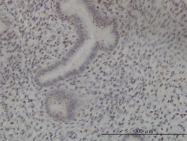 H00079858-M01 - NEK11