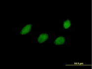 H00079921-B01P - TCEAL4