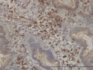 H00080025-M01 - PANK2