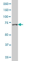 H00080028-M01 - FBXL18