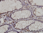 H00080279-M01 - CDK5RAP3