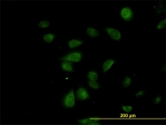H00080279-M01 - CDK5RAP3
