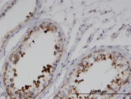 H00080318-M01 - GKAP1