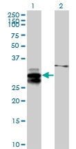 H00080328-B01P - ULBP2 / NKG2D ligand 2