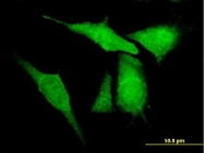 H00080333-B01 - KCNIP4