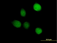 H00080746-B01P - TSEN2 / SEN2