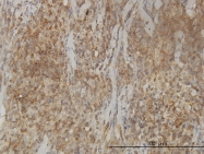 H00081617-M01 - CAB39L