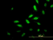 H00081628-M07 - TSC22D4