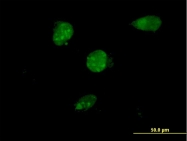 H00081628-M08 - TSC22D4