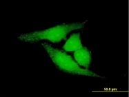 H00081691-B01P - RNA exonuclease NEF-sp