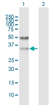 H00081855-B01P - Sideroflexin-3 (SFXN3)