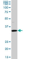 H00081855-M01 - Sideroflexin-3 (SFXN3)