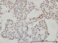 H00083667-M03 - Sestrin-2 (SESN2)