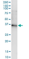 H00083729-D01 - Inhibin beta E chain (INHBE)