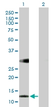 H00083758-B01 - Retinol-binding protein 5 / RBP5