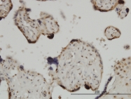 H00084107-M05 - ZIC4