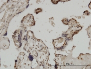 H00084107-M06 - ZIC4