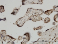 H00084107-M09 - ZIC4