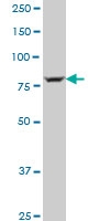 H00084171-A01 - LOXL4